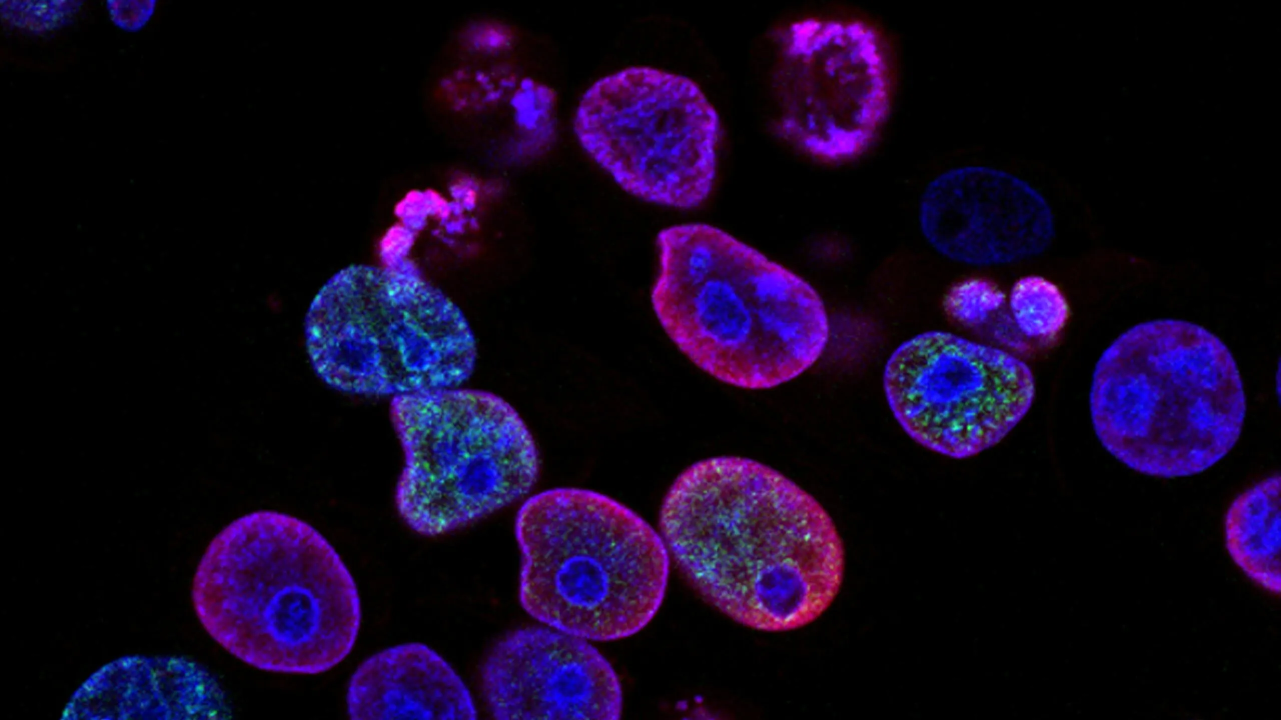 Grzyby lubią nowotwory